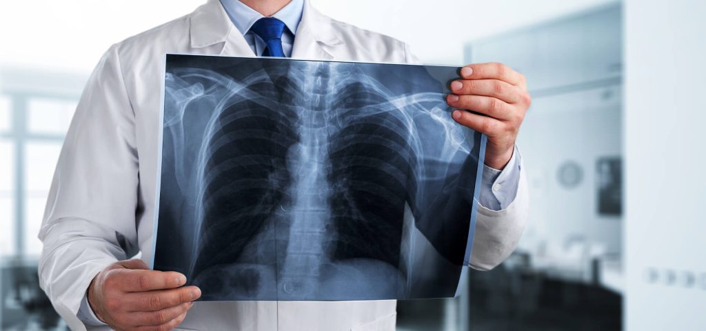 بهترین فوق تخصص ریه کرمان